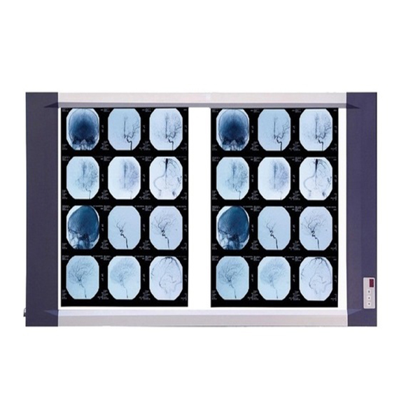LED X-RAY FILM VIEWER DOUBLE PANEL BX-2 BAXTER MEDICAL UK